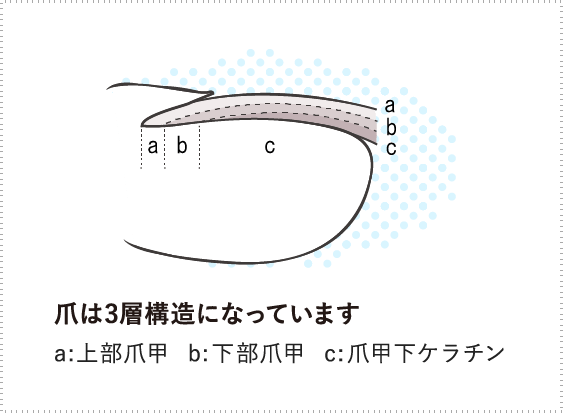 「巻き爪の発生メカニズムに即した治療方法とは」